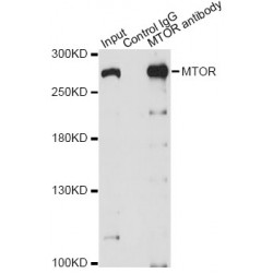 Serine/Threonine-Protein Kinase MTOR (MTOR) Antibody