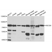 Western blot analysis of extracts of various cell lines, using ABCB8 antibody (abx005962) at 1/1000 dilution.