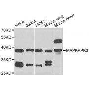 Western blot analysis of extracts of various cell lines, using MAPKAPK3 antibody (abx006016) at 1/1000 dilution.