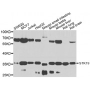 Western blot analysis of extracts of various cell lines, using STK19 antibody (abx006018) at 1/1000 dilution.