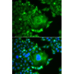 Calcium Voltage-Gated Channel Auxiliary Subunit Gamma 4 (CACNG4) Antibody