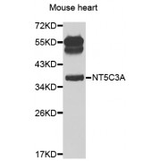 Western blot analysis of extracts of mouse heart, using NT5C3A antibody (abx006023) at 1/1000 dilution.