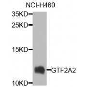 Western blot analysis of extracts of NCI-H460 cells, using GTF2A2 antibody (abx006034) at 1/1000 dilution.