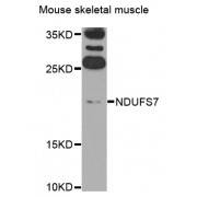 Western blot analysis of extracts of mouse skeletal muscle, using NDUFS7 antibody (abx006041) at 1/1000 dilution.