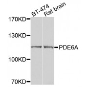 Western blot analysis of extracts of various cell lines, using PDE6A antibody (abx006044) at 1/1000 dilution.