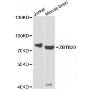 Western blot analysis of extracts of various cell lines, using ZBTB20 antibody (abx006048) at 1/1000 dilution.