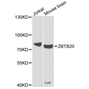 Western blot analysis of extracts of various cell lines, using ZBTB20 antibody (abx006048) at 1/1000 dilution.