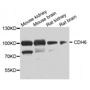 Western blot analysis of extracts of various cell lines, using CDH6 antibody (abx006063) at 1/1000 dilution.
