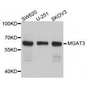 Western blot analysis of extracts of various cell lines, using MGAT3 antibody (abx006071) at 1/1000 dilution.