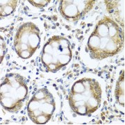 Immunohistochemistry of paraffin-embedded human colon using IFI44 antibody (abx006094) at dilution of 1/100 (40x lens).