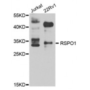 Western blot analysis of extracts of various cell lines, using RSPO1 antibody (abx006117) at 1/1000 dilution.
