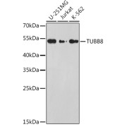 Western blot analysis of extracts of U-251MG (Lane 1), Jurkat (Lane 2), K-562 (Lane 3) cell lysates (25 µg per lane), using TUBB8 antibody (1/1000 dilution), followed by Goat Anti-Rabbit IgG, H+L (https://www.abbexa.com/index.php?route=product/search&amp;search=abx005548" target="_blank">abx005548</a>, 1/10000 µg/ml) and 3% non-fat dry milk in TBST for blocking.