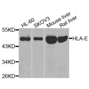 Western blot analysis of extracts of various cell lines, using HLA-E antibody (abx006149) at 1/1000 dilution.