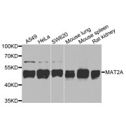 Western blot analysis of extracts of various cell lines, using MAT2A antibody (abx006151) at 1/1000 dilution.