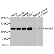 Western blot analysis of extracts of various cell lines, using SMEK1 antibody (abx006167) at 1/1000 dilution.