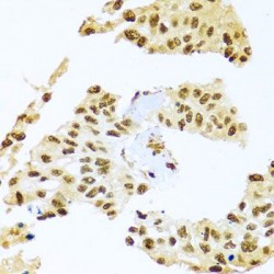 SMEK Homolog 1 (SMEK1) Antibody