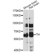 Western blot analysis of extracts of various cell lines, using TH antibody (abx006175) at 1/1000 dilution.