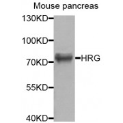 Western blot analysis of extracts of mouse pancreas, using HRG antibody (abx006202) at 1/1000 dilution.