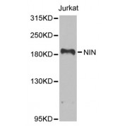 Western blot analysis of extracts of Jurkat cells, using NIN antibody (abx006218) at 1/1000 dilution.