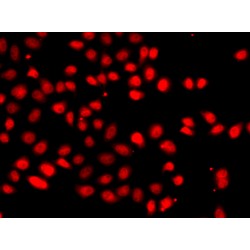 Endothelial PAS Domain-Containing Protein 1 (EPAS1) Antibody
