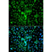 Immunofluorescence analysis of A549 cells using CIDEA antibody (abx006244). Blue: DAPI for nuclear staining.