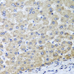 Probable tRNA N6-Adenosine Threonylcarbamoyltransferase, Mitochondrial (OSGEPL1) Antibody