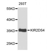 Western blot analysis of extracts of 293T cells, using KIR2DS4 antibody (abx006269) at 1/1000 dilution.