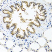 Immunohistochemistry of paraffin-embedded rat lung using S100A7 antibody (abx006275) at dilution of 1/100 (40x lens).