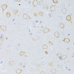 Tetraspanin 30 / TSPAN30 (CD63) Antibody