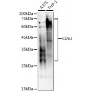 Western blot analysis of extracts of various cell lines using CD63 Antibody (1/1000 dilution).