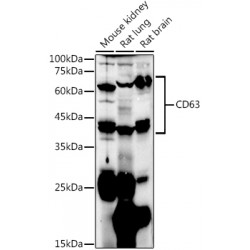 Tetraspanin 30 / TSPAN30 (CD63) Antibody