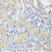 Immunohistochemistry of paraffin-embedded mouse kidney using CYP4A11 antibody (abx006298) at dilution of 1/100 (40x lens).