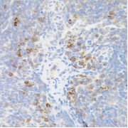 Immunohistochemistry of paraffin-embedded mouse spleen using TNFRSF13B antibody (abx006303) at dilution of 1/100 (40x lens).