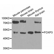 Western blot analysis of extracts of various cell lines, using FOXP3 antibody (abx006307) at 1/1000 dilution.