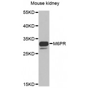 Western blot analysis of extracts of mouse kidney, using M6PR antibody (abx006336) at 1/1000 dilution.
