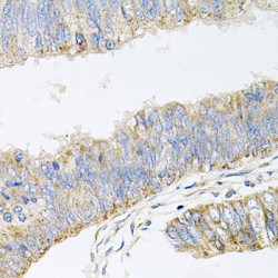 Pancreatic Secretory Granule Membrane Major Glycoprotein GP2 (GP2) Antibody
