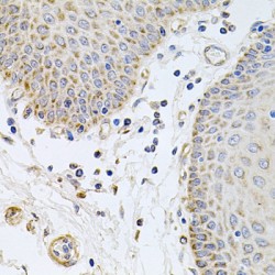 Pancreatic Secretory Granule Membrane Major Glycoprotein GP2 (GP2) Antibody