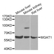 Western blot analysis of extracts of various cell lines, using MGAT1 Antibody (abx006347) at 1/1000 dilution.