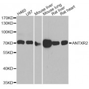 Western blot analysis of extracts of various cell lines, using ANTXR2 antibody (abx006356) at 1/1000 dilution.