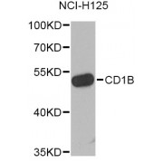 Western blot analysis of extracts of NCI-H125 cells, using CD1B Antibody (abx006357) at 1/1000 dilution.