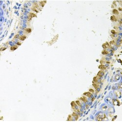 Kallikrein 11 (KLK11) Antibody