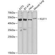 Western blot analysis of extracts of various cell lines, using KLK11 Antibody (abx006376) at 1/1000 dilution.