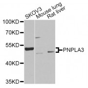 Western blot analysis of extracts of various cell lines, using PNPLA3 Antibody (abx006383) at 1/1000 dilution.