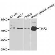Western blot analysis of extracts of various cell lines, using TINF2 antibody (abx006391) at 1/1000 dilution.