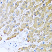 Immunohistochemistry of paraffin-embedded human liver using CCL8 antibody (abx006410) at dilution of 1/100 (40x lens).