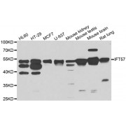 Western blot analysis of extracts of various cell lines, using IFT57 antibody (abx006437) at 1/1000 dilution.