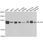 Western blot analysis of extracts of various cell lines, using BLVRB antibody (abx006443) at 1/1000 dilution.