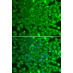 Kelch Repeat And BTB Domain-Containing Protein 7 (KBTBD7) Antibody