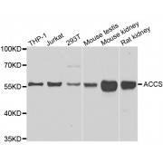 Western blot analysis of extracts of various cell lines, using ACCS antibody (abx006477) at 1/1000 dilution.