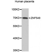 Western blot analysis of extracts of Human placenta, using ZNF549 antibody (abx006483) at 1/1000 dilution.